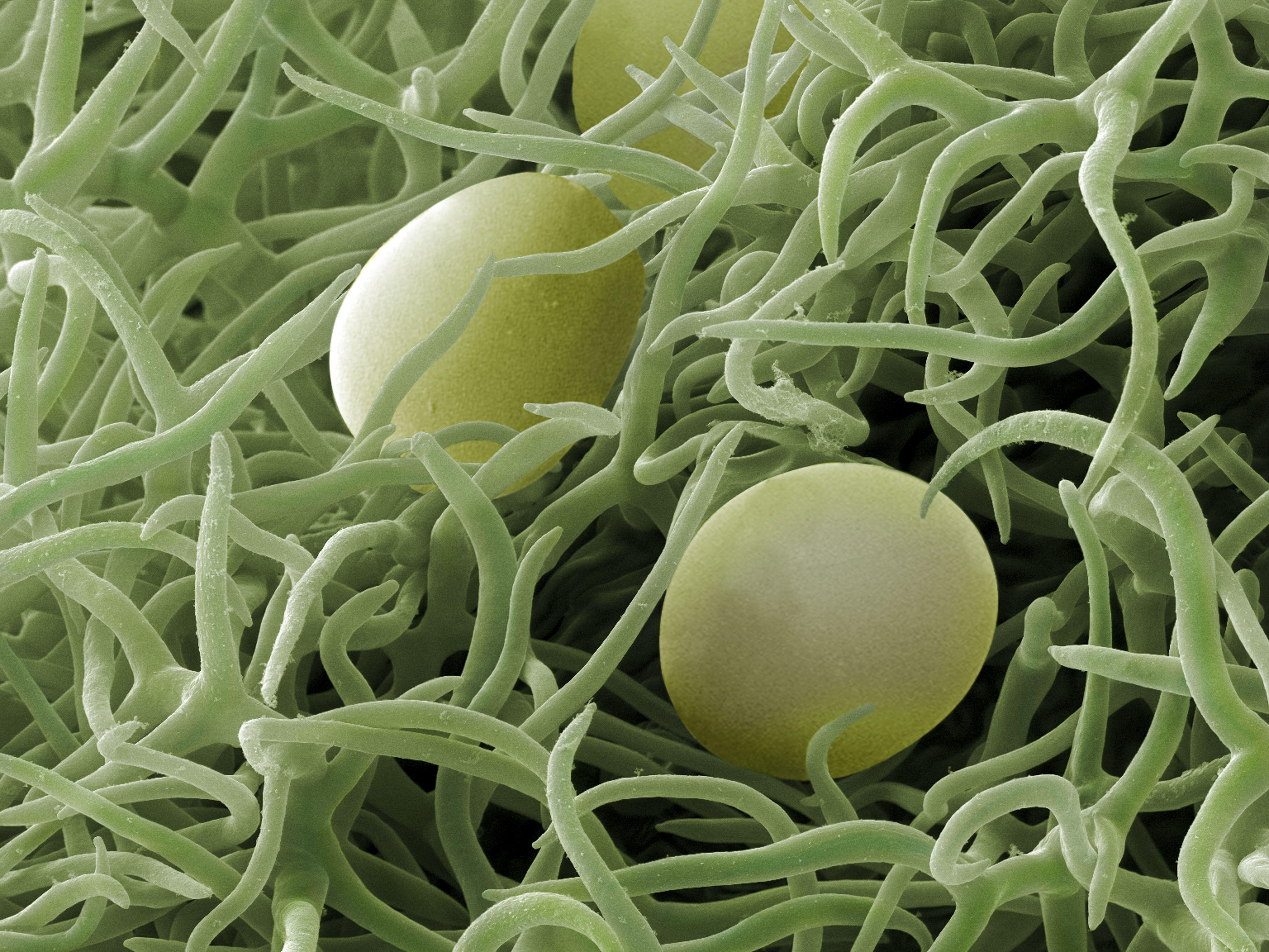 Scanning electron micrograph (SEM) of a leaf of the Rosemary plant (Rosmarinus officinalis). Spherical oil glands are found amongst the branched hairs